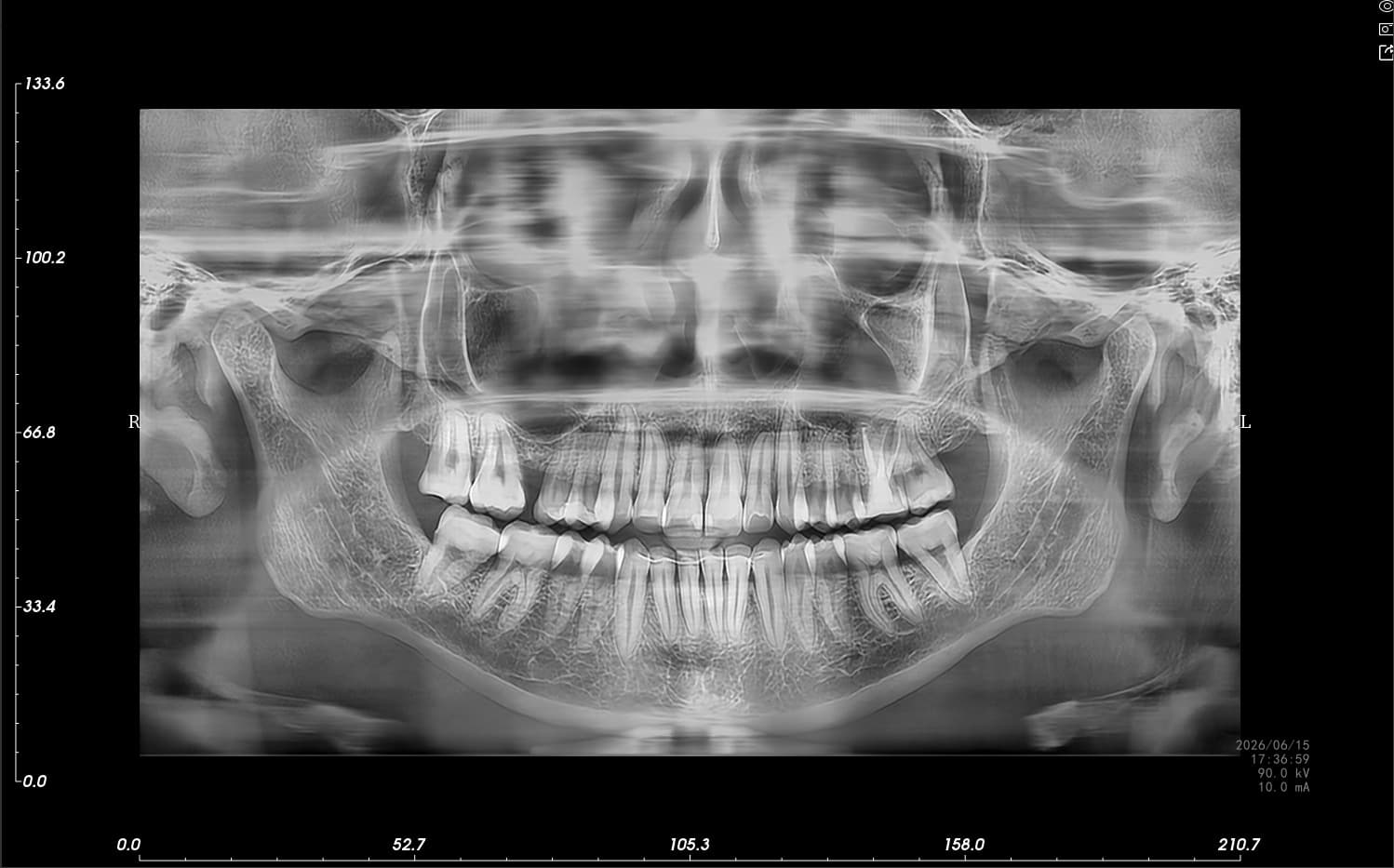 Radiografía panorámica dental